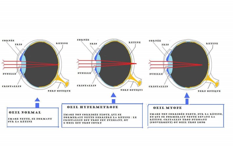 Schma de l'oeil